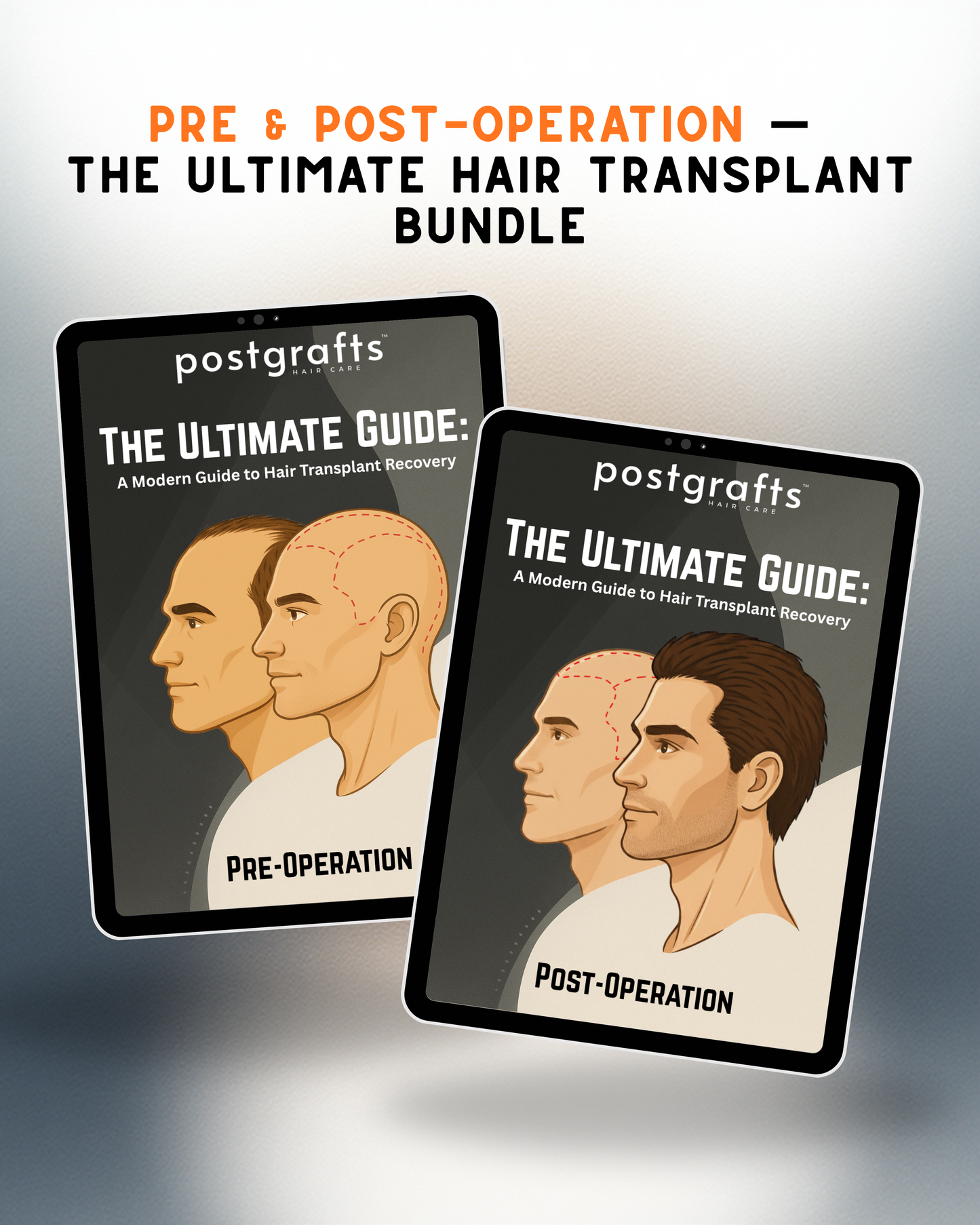 Complete Hair Transplant Bundle