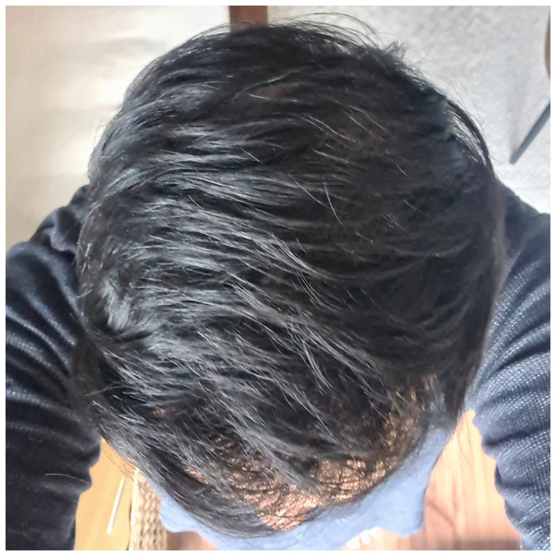 After 12 months of recovery