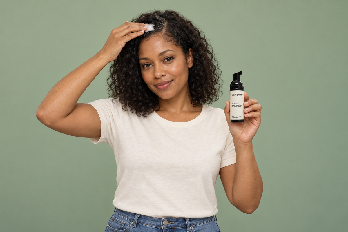 A Postgrafts customer holding the 5% Minoxidil scalp foam